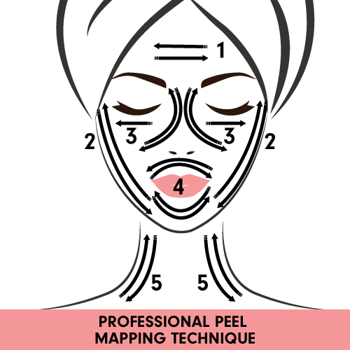 Professional Peel Mapping Technique